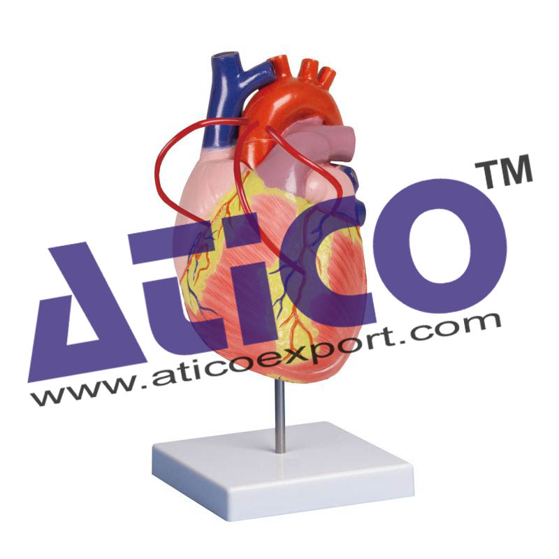 Heart With Bypass Model