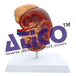 Kidney with Adrenal Gland, 3X life size